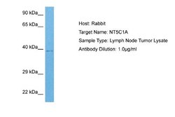 NT5C1A Rabbit anti-Human, Polyclonal, Novus Biologicals 0.1 mL | Buy Online | Novus Biologicals | Fisher Scientific